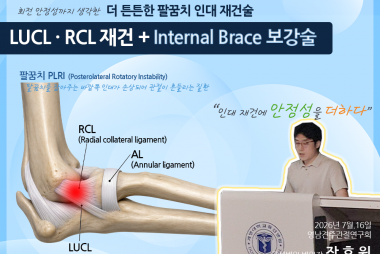 팔꿈치 불안정성의 안정적 치료를 위한 인대 재건술 및 …
