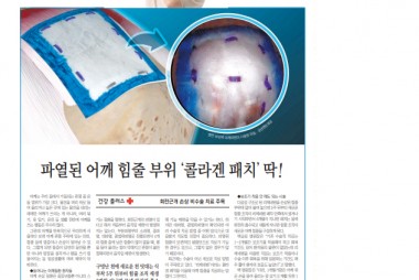 파열된 어깨 힘줄 부위 '콜라겐 패치' 딱! [매일신문…